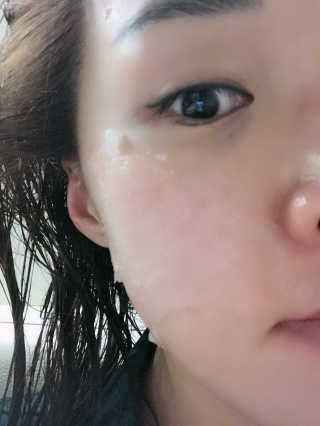 메디타임 멜라반 더마 토닝 씬젤 — 3점을 준 리뷰어가 2019년 4월 올린 사용 사진