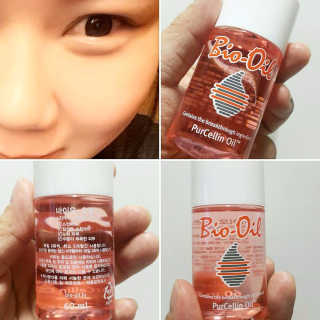 Bio-oil(바이오오일) 바이오오일 — 4.5점을 준 리뷰어가 2016년 10월 올린 사용 사진