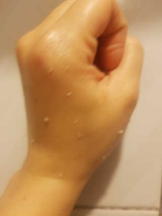 타임인네이처 [더메디닥터] 카렌듈라 엔자임 필링젤 — 5점을 준 리뷰어가 2019년 2월 올린 사용 사진