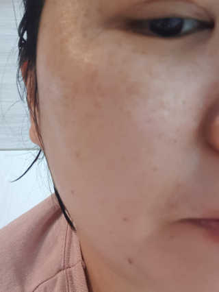 NDR 엔디알 엔디알 피토 에이 앰플 — 2.5점을 준 리뷰어가 2020년 1월 올린 사용 사진
