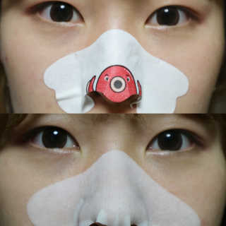 나이팅게일 TAKO PACK NOSE [문어코팩] — 4점을 준 리뷰어가 2016년 12월 올린 사용 사진