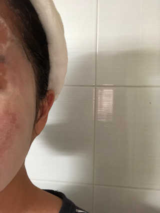 셀퓨전씨 트리악 포어 딜리트 버블 팩 — 4.33점을 준 리뷰어가 2018년 4월 올린 사용 사진
