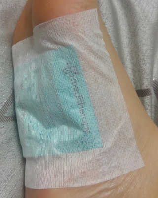 메디테라피 더마 릴렉스 힐링패치 — 4.5점을 준 리뷰어가 2018년 4월 올린 사용 사진