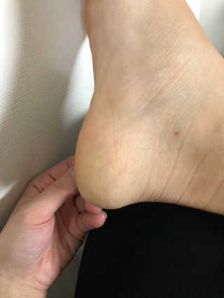 비니주니맘 :D님이 올린 리뷰 사진 2