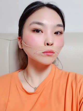 아이디플라코스메틱 아이디 페이스핏 마이너스 밴드 — 3.5점을 준 리뷰어가 2019년 12월 올린 사용 사진