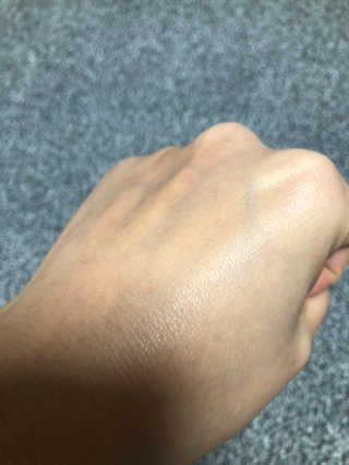리얼베리어 시카릴리프 젤 밤 — 5점을 준 리뷰어가 2019년 3월 올린 사용 사진