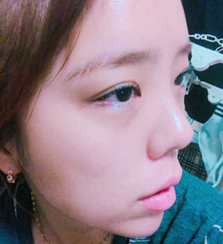셀리맥스 노니 에너지 앰플 — 5점을 준 리뷰어가 2019년 9월 올린 사용 사진