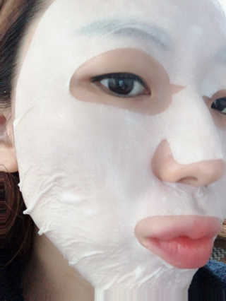 유산균하우스 [프로바이오닉]스킨프로바이오틱스 마스크 10매입 — 3점을 준 리뷰어가 2019년 4월 올린 사용 사진