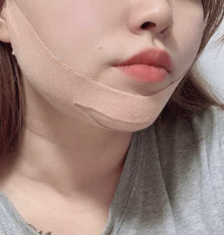 아이디플라코스메틱 아이디 페이스핏 마이너스 밴드 — 4점을 준 리뷰어가 2019년 11월 올린 사용 사진