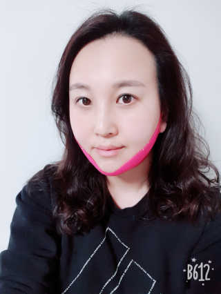 스케덤 펩타이드 리프팅밴드 — 5점을 준 리뷰어가 2019년 3월 올린 사용 사진