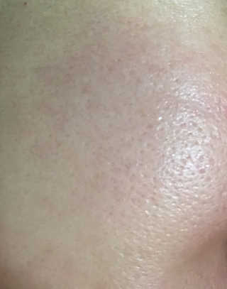 프리[더메디코템] 일루미네이팅 화이트 셀 앰플 — 5점을 준 리뷰어가 2018년 9월 올린 사용 사진