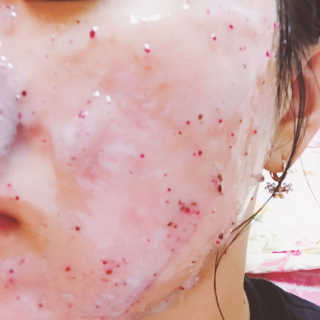23years old 아쿠아밥 모델링 마스크 — 5점을 준 리뷰어가 2017년 5월 올린 사용 사진