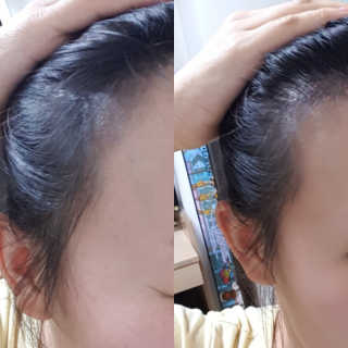 다슈코리아 다슈 안티 헤어로스 헤어쿠션 16g — 5점을 준 리뷰어가 2017년 12월 올린 사용 사진