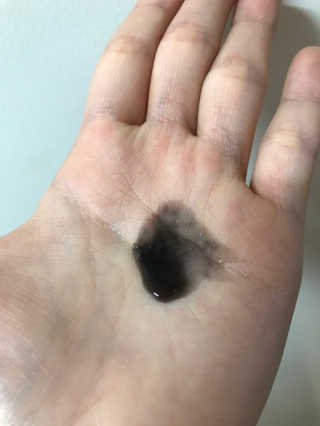 the naked object [탈모볼륨샴푸] 디블랙 팩 샴푸 — 4점을 준 리뷰어가 2019년 12월 올린 사용 사진