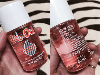 Bio-oil(바이오오일) 바이오오일(Bio-oil) — 4점을 준 리뷰어가 2017년 1월 올린 사용 사진