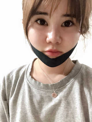 어웨이크어슬립 어슬립 페이스 리프트업 밴드 — 3.33점을 준 리뷰어가 2018년 6월 올린 사용 사진