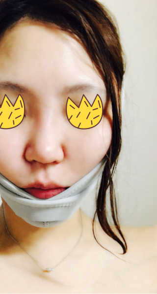 메디미 브이미 업 2스텝 브이라인벨트 — 5점을 준 리뷰어가 2017년 6월 올린 사용 사진
