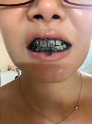 the naked object 디블랙팩치약 디블랙칫솔 세트 — 4점을 준 리뷰어가 2019년 6월 올린 사용 사진