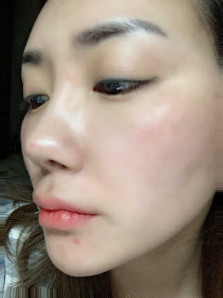 이지함 메디컬러 핑크원 블루원 그린원 — 4점을 준 리뷰어가 2019년 6월 올린 사용 사진
