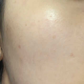 오지아이 워터 밤 모이스처 스킨 에센스 180ml — 5점을 준 리뷰어가 2020년 1월 올린 사용 사진