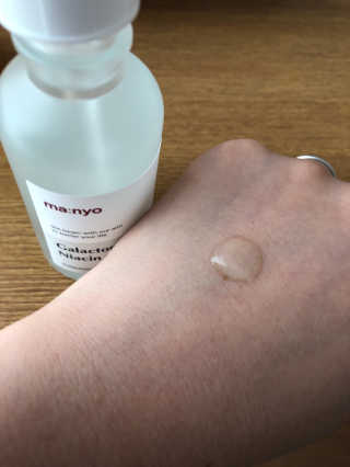 [마녀 공장] 발가락 토미 니아신 에센스 50ml — 3.5점을 준 리뷰어가 2019년 6월 올린 사용 사진