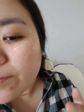 셀레뷰 슈퍼 모이스처 수딩젤 — 4점을 준 리뷰어가 2018년 3월 올린 사용 사진