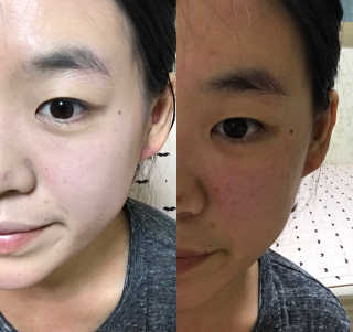 데이셀코스메틱 메디 랩 블랙로즈 블로썸 비비 50g — 3.67점을 준 리뷰어가 2017년 6월 올린 사용 사진