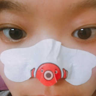 나이팅게일 TAKO PACK NOSE [문어코팩] — 4점을 준 리뷰어가 2017년 4월 올린 사용 사진