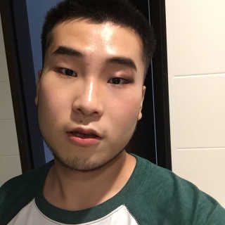 나이팅게일 데일리 더마 클렌징패드 마일드 (20매) — 4점을 준 리뷰어가 2017년 8월 올린 사용 사진
