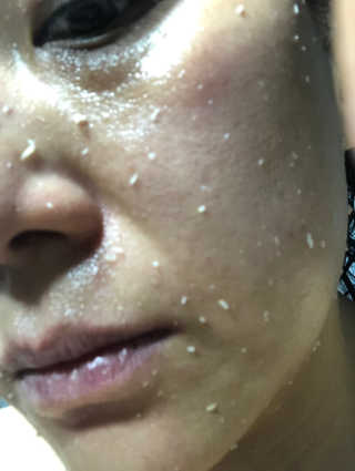 타임인네이처 [더메디닥터] 카렌듈라 엔자임 필링젤 — 4점을 준 리뷰어가 2019년 3월 올린 사용 사진