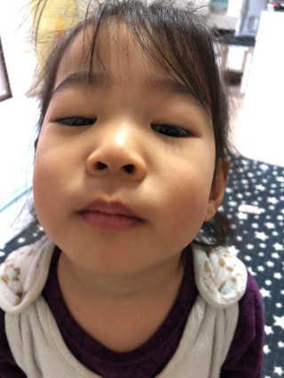 블리스텍스 립 릴리프 크림 립밤, 립 바이브런스 립밤 — 5점을 준 리뷰어가 2018년 11월 올린 사용 사진