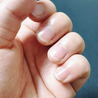 [후르디아] 블루베리 과즙 듬뿍 꿀과즙립밤 3개 세트 — 4점을 준 리뷰어가 2019년 11월 올린 사용 사진