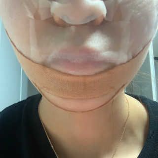 아이디플라코스메틱 아이디 페이스핏 마이너스 밴드 — 4점을 준 리뷰어가 2019년 12월 올린 사용 사진