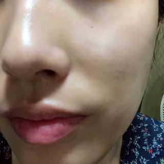 셀루닉 래디언스 퍼밍 크림  앰플속크림 — 4.33점을 준 리뷰어가 2018년 8월 올린 사용 사진