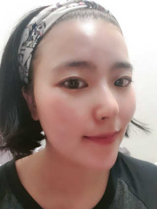 나이팅게일 더마 큐어솔루션 티타민 앰플 — 5점을 준 리뷰어가 2019년 4월 올린 사용 사진