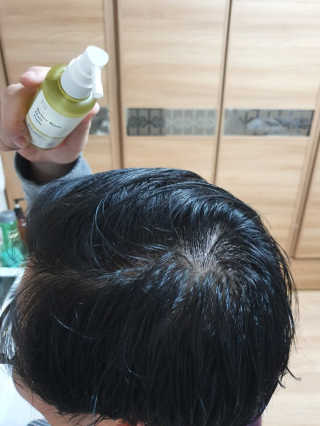 달리프 클로렐라 베러 루트 헤어토닉 100ml — 5점을 준 리뷰어가 2020년 3월 올린 사용 사진