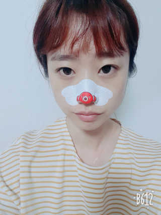 나이팅게일 TAKO PACK NOSE [문어코팩] — 5점을 준 리뷰어가 2018년 5월 올린 사용 사진