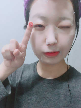 [더마허브] 주사팩 5종, 물광,백옥,태반,신데렐라 등 — 4점을 준 리뷰어가 2018년 3월 올린 사용 사진