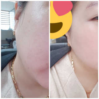 서녕이님이 올린 리뷰 사진 3