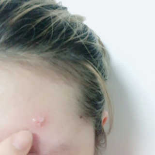 라포랩 laforlab 라포랩 센텔라스카 연고(바질) — 4점을 준 리뷰어가 2017년 12월 올린 사용 사진