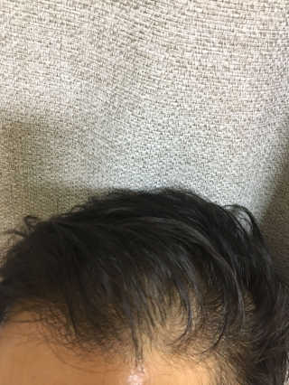 다슈코리아 다슈 스페셜 에디션 와일드 디자인 머클왁스 — 4.83점을 준 리뷰어가 2018년 3월 올린 사용 사진