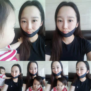 어웨이크어슬립 어슬립 페이스 리프트업 밴드 — 4점을 준 리뷰어가 2018년 5월 올린 사용 사진