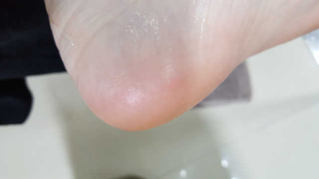 베베풋글라스 시즌2 리뷰 사진