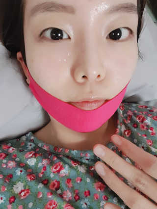 스케덤 펩타이드 리프팅밴드 — 4점을 준 리뷰어가 2019년 3월 올린 사용 사진