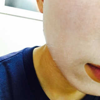 23years old 홈 더마실 마스크 — 4점을 준 리뷰어가 2016년 12월 올린 사용 사진