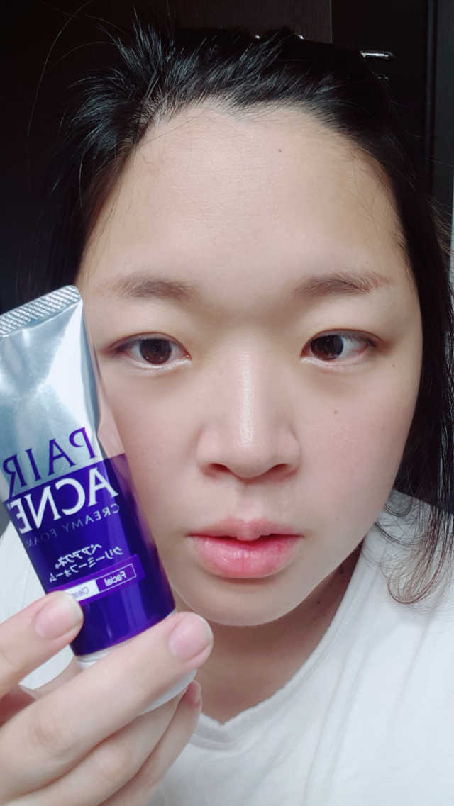 페어아크네 크리미 폼 리뷰 사진