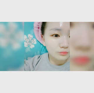 에슬레나 엑스트라 밸런싱 힐링 마스크 10장 — 5점을 준 리뷰어가 2017년 10월 올린 사용 사진
