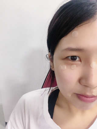 23years old 바데카실 닥토 — 3.67점을 준 리뷰어가 2018년 4월 올린 사용 사진