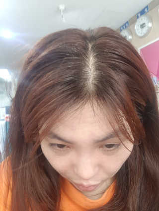 닥터모두 홈스파 스칼프 샴푸 300ml + 헤어토닉 — 3점을 준 리뷰어가 2019년 2월 올린 사용 사진