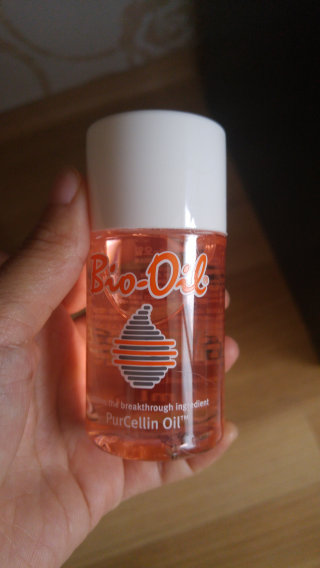 Bio-oil(바이오오일) 바이오오일(Bio-oil) — 3.5점을 준 리뷰어가 2016년 8월 올린 사용 사진